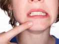 /album/fotogaleria-fotoshop/sin-grano-jpg/
